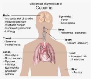 Side Effects Of Chronic Use Of Cocaine - Cocaine Side Effects #238801