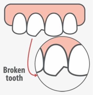 What Is A Dental Emergency #2317505