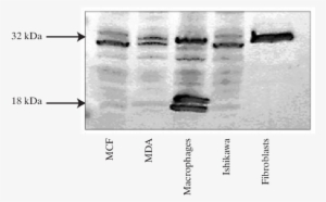 Western Immunoblot Analysis For Pbr In Different Neoplastic - Composite Material #2321247