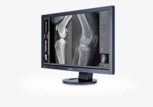 Or Technology's Dicompacs® Diagnostic Software Is Designed - Radiography #2323753