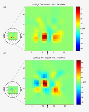 Reconstruction Of Baby A's Optical Topography Data - Diagram #2333545