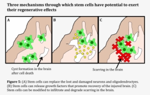 Subjective Essay Xex - Tree #2361449