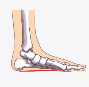 My Program Made Use Of This Old-school Wisdon, Combined - Straight Feet Problem #2374185