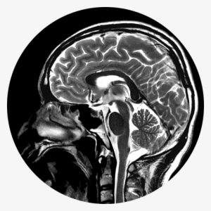 Brain, Head & Spine Imaging Image - Lmp Enfermedad #2382918