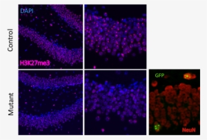 Methylation Status And Mecp2-gfp Reactivation Are Shown - Xist #2383209 Methylation Status And Mecp2-gfp Reactivation Are Shown - Xist #2383209