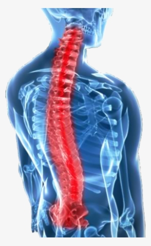 Kuala Lumpur Spine - Whiplash: Evidence Base For Clinical Practice #2383327