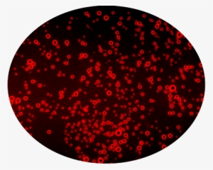 ¿cómo Actúan Las Burbujas Lipídicas - Portable Network Graphics #2394466