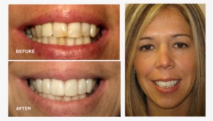 Dental Smile - Dr. Philip M. Tornatore, Dds - Dentist In Hicksville #2394904