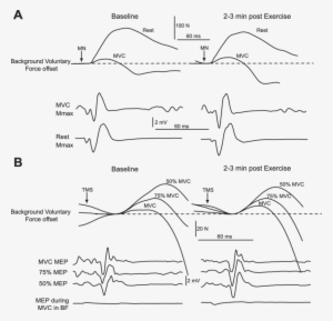 Raw Traces Of Twitch Forces And Electromyographic Responses - Force #2424072