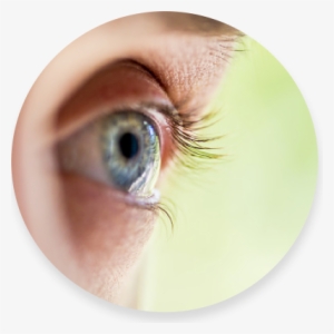 Contact Lens - Bolsa De Agua Dentro Del Ojo #2486565