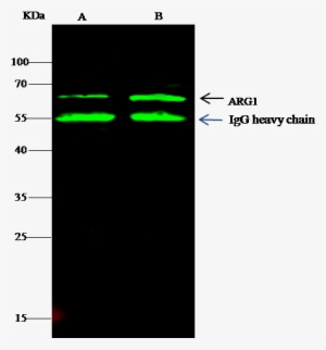 Schistosoma Japonicum Glutathione S-transferase/gst - Mapk14 #2541607