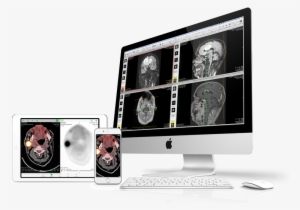 Devices-osirix - Opal Tech Solutions #2588658