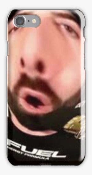 'keemstar' Iphone Case By Skolastrakur - Iphone #262319