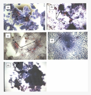 Kb Cells Were Cultured In Dmem-10% Fcs Medium For 5 - Visual Arts #264562