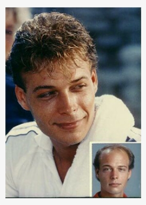 Ready Made Men Hair Toupee - Portrait Photography #2615189