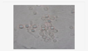 Showing Conjugation Tubes In E - Drop #2621909