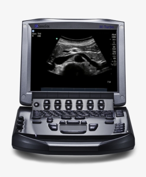 Sonosite M-turbo® Ultrasound System - M Turbo #2649095