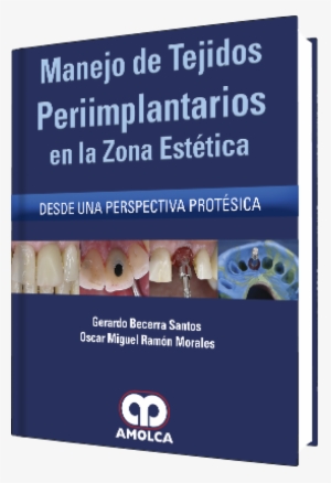 Manejo Tejidos Periimplantarios En Zona Estetica - Surgery #2654052