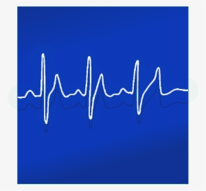 Mb Image/png - Electrocardiography #272210