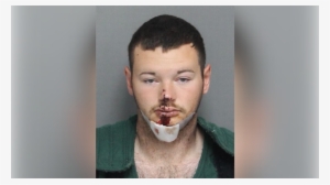 Sc Man Killed Horse, Shot Himself In The Face With - Maniac Face #2721539 Sc Man Killed Horse, Shot Himself In The Face With - Maniac Face #2721539