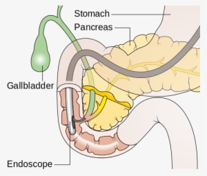 The Process Of Taking These X-rays Is Known As Cholangiopancreatography - Endoscopic Retrograde Cholangiopancreatography #2729095