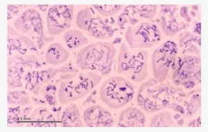 Prepared Slides, Meiosis In Animal Cell, Grasshopper, - Cell #2749123