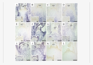 In Situ Localization Of Csvd In Infected In Vitro Culture - Shoot #2753848