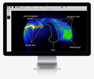 Mac Display Overlay Portoazygousshunt - Advanced Veterinary Medical Imaging #2787026