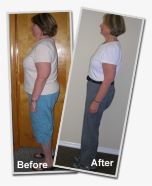 Hcg Before And After Weight Loss Pictures Pat - Hcg Success Stories #2792732