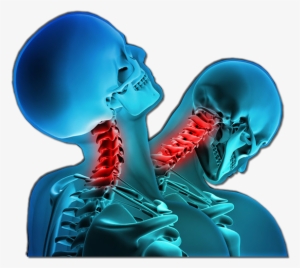 Whiplash Injury #2798967