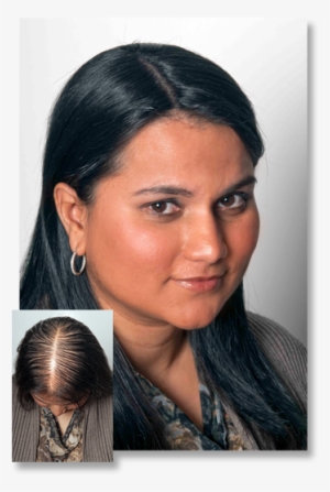 Thinning Hair - Does Thinning Hair Look Like Female #2802179