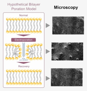 The Cooling Effect Results In A Higher Stimulation - エレクトロ ポ レーション ケアシス #2806516