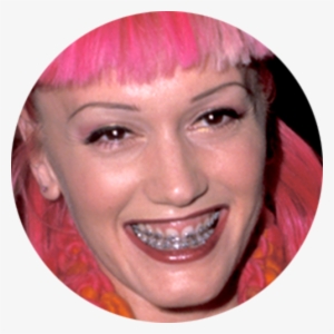 Gwen Stefani Was Another Famous Face Who Was Brave - Gwen Stefani Botox Plastic Surgery #2828117