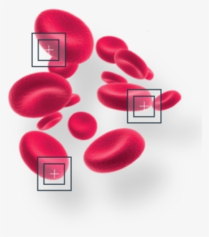 Computer Vision Instead Of Traditional Coulter Counting - Red Blood Cell #2832383