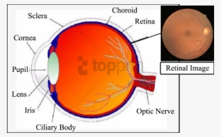 Human Eye Cross-sectional View With An Example Of A - Cross Sectional View Of Eye #2836926