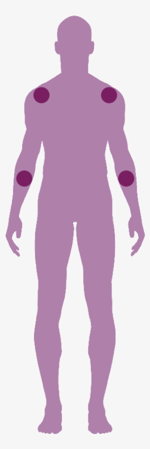 Arm Pain - Pain #2846457