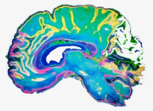 Brain Scan Transparent - Green Tea Good For Brian #2852886