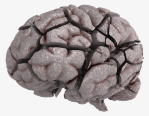 Choose A 'brain Break Or A Brain Brake' Making Choices - Bone Fracture #2868107