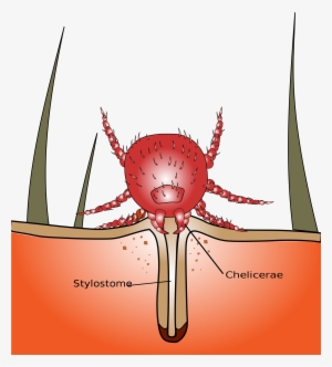 Open - Chigger Bug #2871929