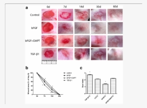 Full-thickness Dermal Wounds Were Induced In Rabbit - Wound #2892394
