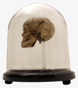 18th Century Human Skull In A Victorian Glass Dome - Skull #2909046