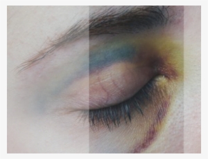 Helatomic-bruises - Cracked Spines #2928224