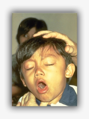 Whooping Cough #2952334