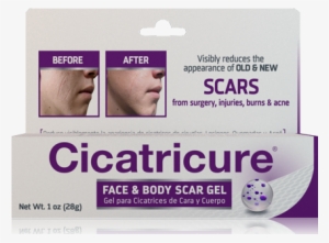 It All Started - Cicatricure Face And Body Scar Gel #2968710