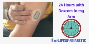 24 Hours With A Dexcom Arm Site - Dexcom G6 On Arm #306910