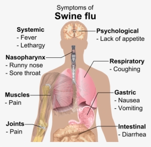 Symptoms Of Swine Flu - Swine Flu Symptoms #312258