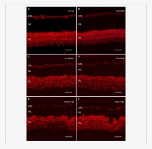 Cryostat Sections Stained Against Bassoon To Visualize - Immunostaining #3124306