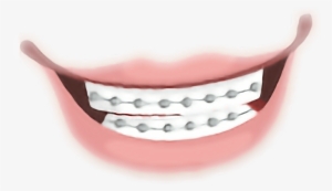 Report Abuse - Tongue #3126871