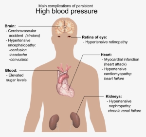 Main Complications Of Persistent High Blood Pressure - Do You Know If You Have High Blood Pressure #3166462