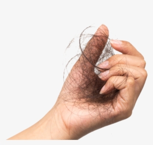 Experience Hair Loss At Some Time In Their Lives - Tea #320513